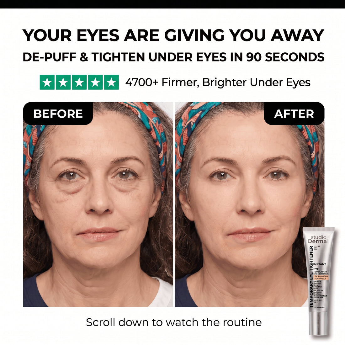 Side-by-side comparison of a woman's under-eye area before and after applying a tightening eye treatment